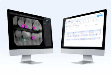 SOTA Cloud Dental Imaging Software Gets Pearl’s AI Pathology Detection