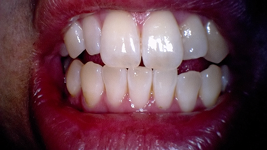 Smart Camera with Mouthwatch