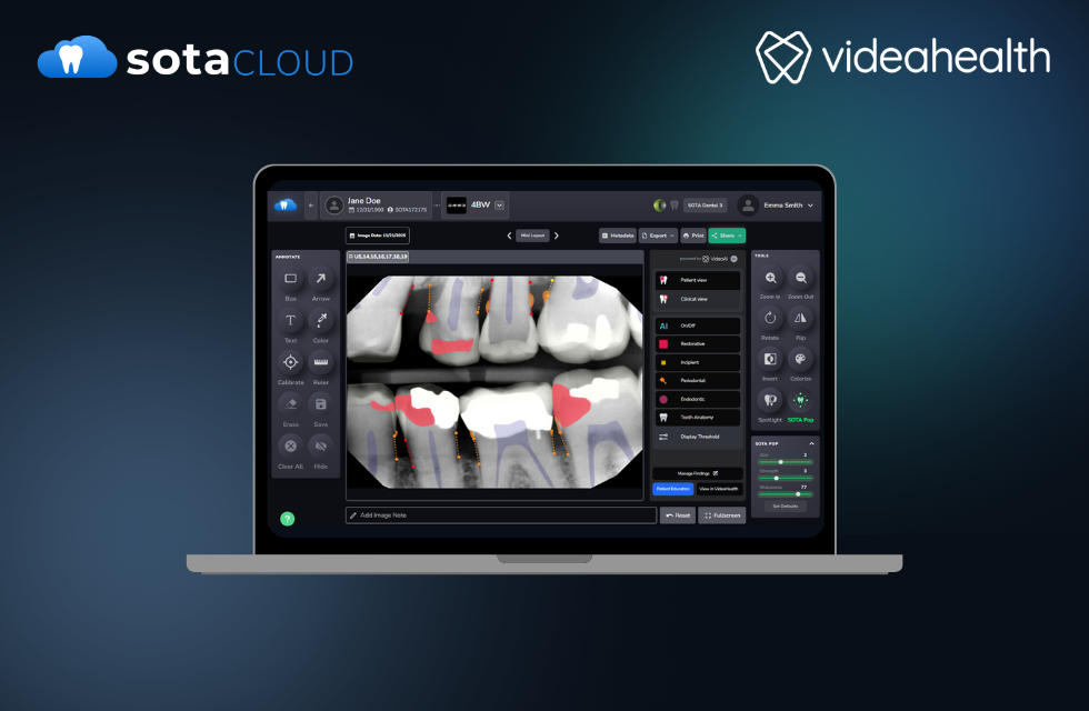 SOTA Cloud and VideaHealth Finalize Integration, Bringing Real-Time AI Insights to the Point of Care